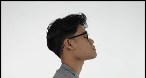 RADi