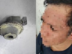Lelaki Melecur Muka Dalam Kebakaran Kepala Gas Dapur di Putatan